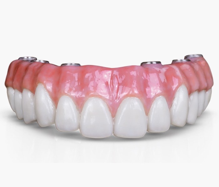 Advanced Prosthetic Attachment