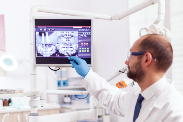 CEREC Restoration Uses