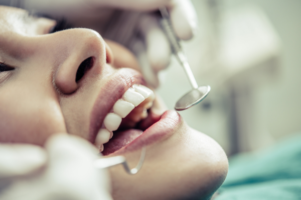 Dental Bonding Treatments