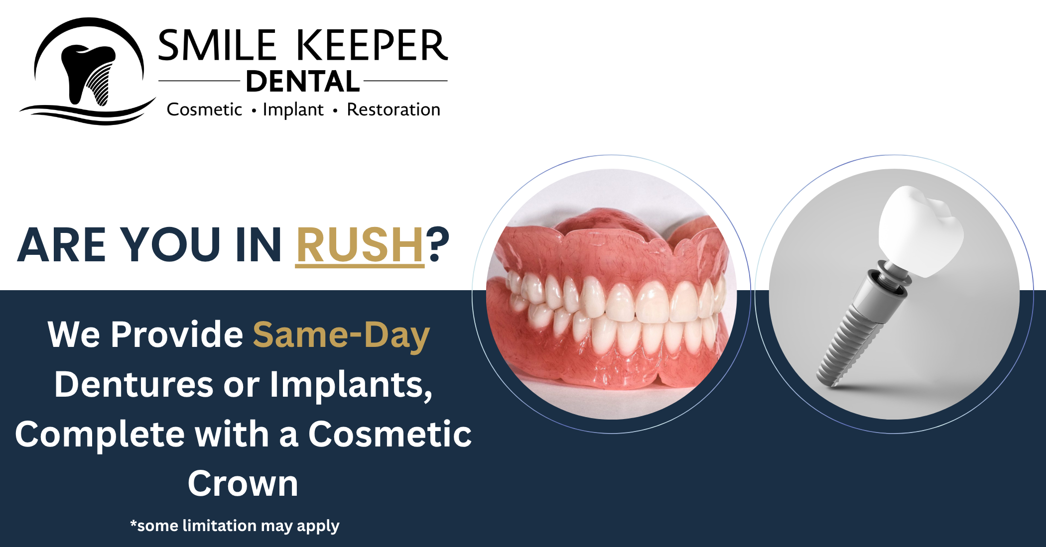 Same day Implant/Denture