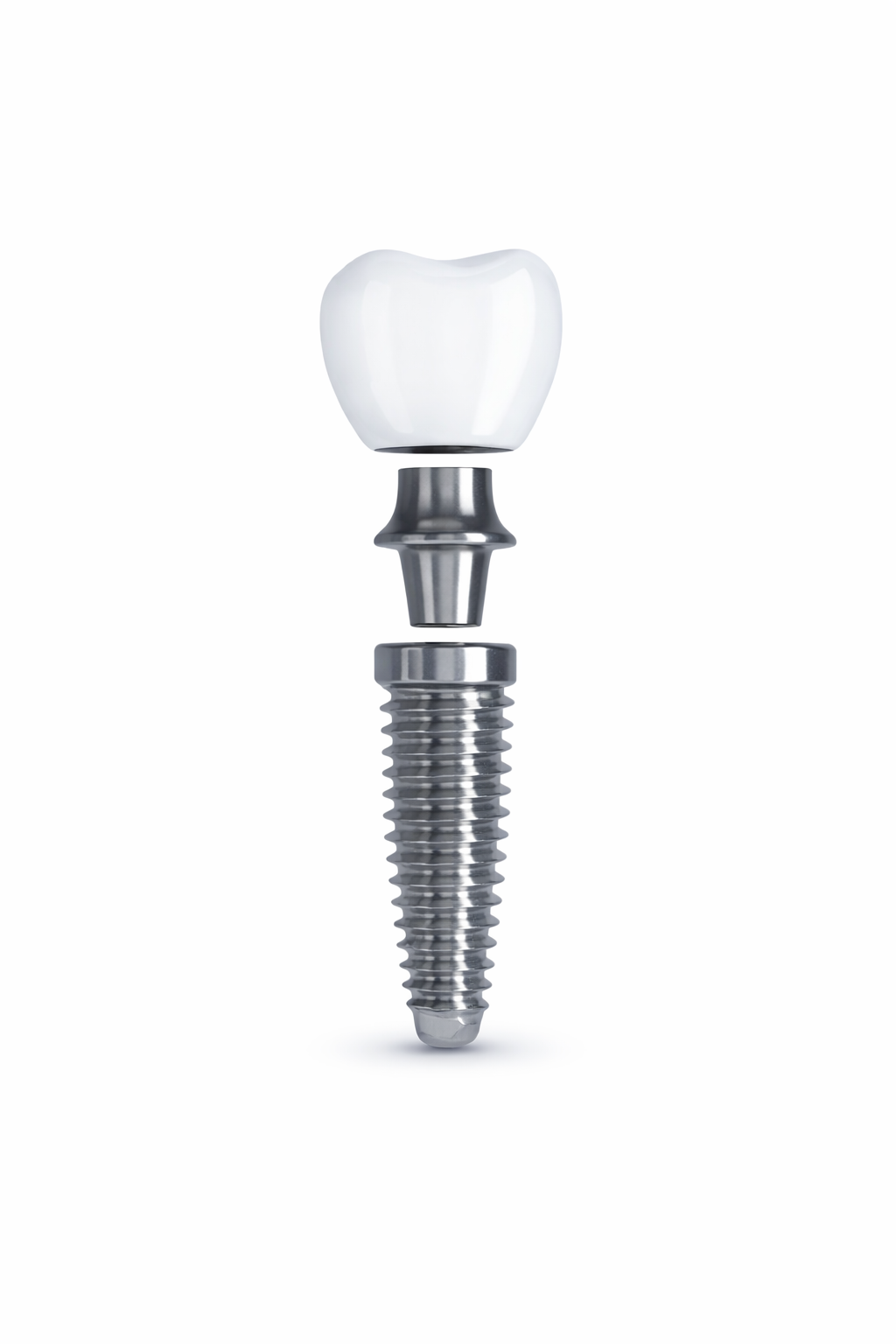 Dental implant structure
